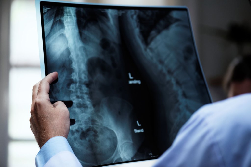 doctor-with-patient-s-x-ray-film.jpg doctor-with-patient-s-x-ray-film.jpg